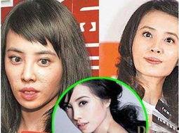 某整形医生爆料新闻视频,揭秘整形手术背后的真相  第3张